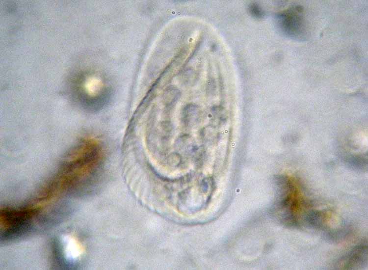 Protozoi del muschio: Phacodinium metchnicoffi ?